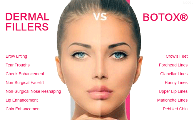 dermal fillers delray